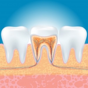implantes dentales en madrid