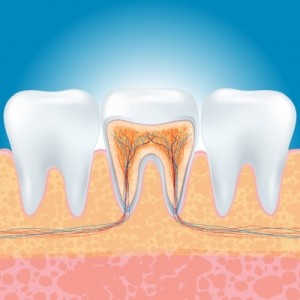 implantes dentales en madrid