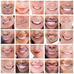estetica dental