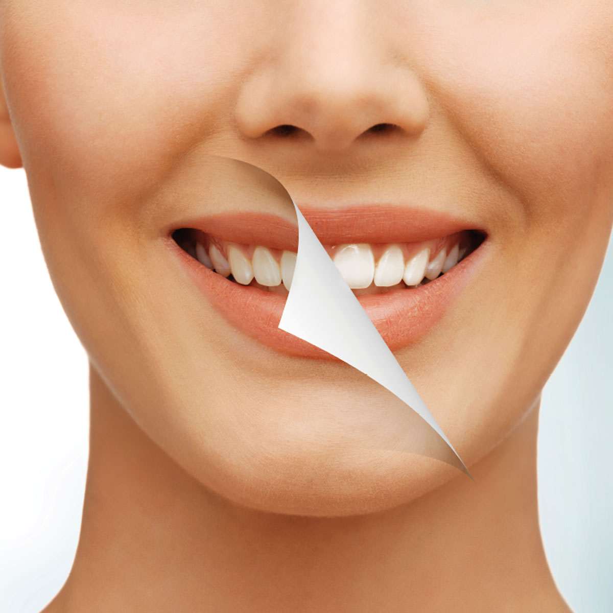Pendiente Avispón Prever Blanqueamiento dental, efectos sobre tus dientes.